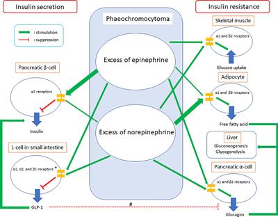 Glucose Intolerance on Phaeochromocytoma and Paraganglioma—The Current Understanding and Clinical Perspectives